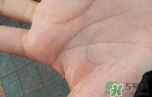 埋線雙眼皮需要拆線嗎？埋線雙眼皮怎么拆線