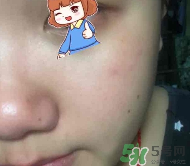 雙妹適合什么年齡？雙妹適合什么膚質(zhì)？