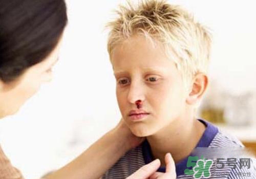 半夜流鼻血是什么原因？半夜流鼻血怎么辦？