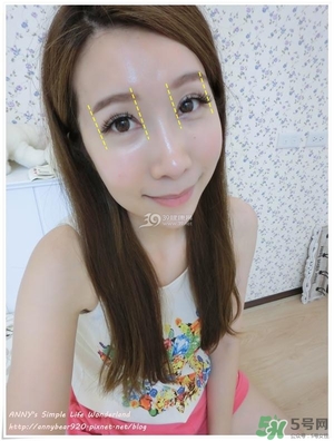 重瞼術(shù)多久能完全消腫 重瞼術(shù)恢復(fù)過程圖 重瞼術(shù)多久能完全消腫 重瞼術(shù)恢復(fù)過程圖