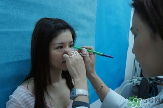 重瞼術(shù)是什么？重瞼術(shù)是永久的嗎？