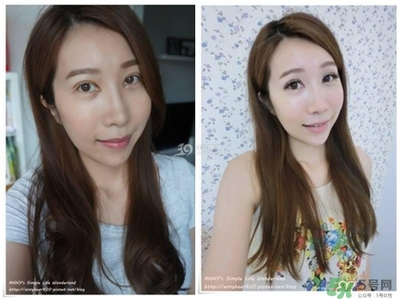 重瞼術(shù)多久能完全消腫 重瞼術(shù)恢復(fù)過程圖 重瞼術(shù)多久能完全消腫 重瞼術(shù)恢復(fù)過程圖