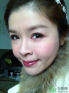 重瞼術(shù)是什么？重瞼術(shù)是永久的嗎？