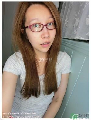 重瞼術(shù)多久能完全消腫 重瞼術(shù)恢復(fù)過程圖 重瞼術(shù)多久能完全消腫 重瞼術(shù)恢復(fù)過程圖