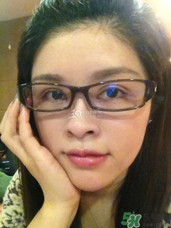 重瞼術(shù)是什么？重瞼術(shù)是永久的嗎？