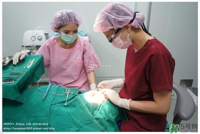 重瞼術(shù)多久能完全消腫 重瞼術(shù)恢復(fù)過程圖 重瞼術(shù)多久能完全消腫 重瞼術(shù)恢復(fù)過程圖