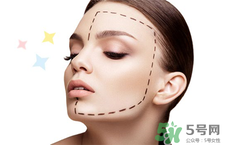 地包天是怎么形成的?地包天要怎么矯正? 地包天是怎么形成的?地包天要怎么矯正?