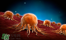 脂肪瘤會遺傳嗎?脂肪瘤會傳染嗎 脂肪瘤會遺傳嗎?脂肪瘤會傳染嗎