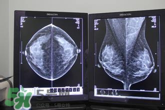 怎么減肥胸部不會變?。繙p肥不減胸的最好辦法