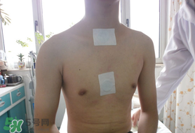 三九貼怎么貼？三九貼的貼法