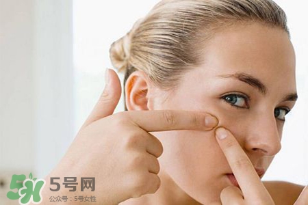 膠原蛋白能祛痘嗎？膠原蛋白可以祛痘嗎？