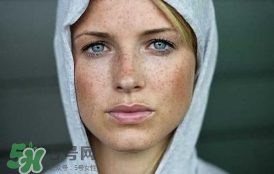 藏紅花能去黃褐斑嗎?怎么去黃褐斑最有效 藏紅花能去黃褐斑嗎?怎么去黃褐斑最有效