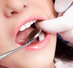 智齒拔完后有個(gè)洞怎么辦？拔智齒后有個(gè)洞多久能長(zhǎng)好？