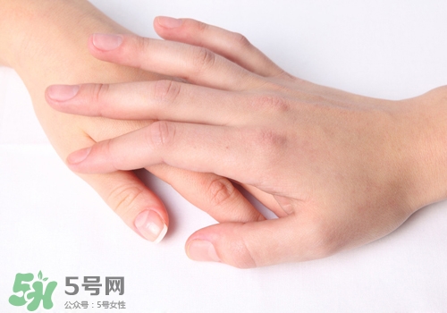 手凍裂開了怎么辦?手凍裂開了涂什么藥? 手凍裂開了怎么辦?手凍裂開了涂什么藥?