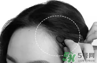 發(fā)際線高適合什么發(fā)型？發(fā)際線高怎么辦