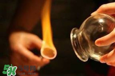 拔罐放血能治皮膚病嗎？拔罐放血能治牛皮癬嗎？