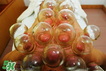 拔罐放血能治皮膚病嗎？拔罐放血能治牛皮癬嗎？