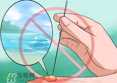 水泡怎么處理？水泡要不要刺破？