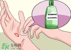 水泡怎么處理？水泡要不要刺破？