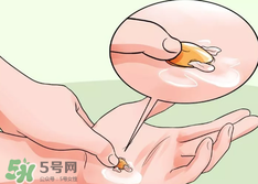 水泡怎么處理？水泡要不要刺破？