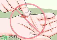 水泡怎么處理？水泡要不要刺破？