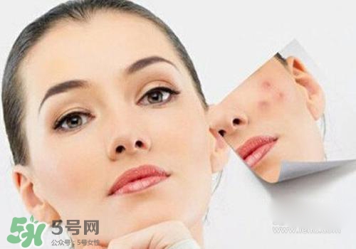 封閉性粉刺會(huì)自己消失嗎？封閉性粉刺好了會(huì)留疤嗎？