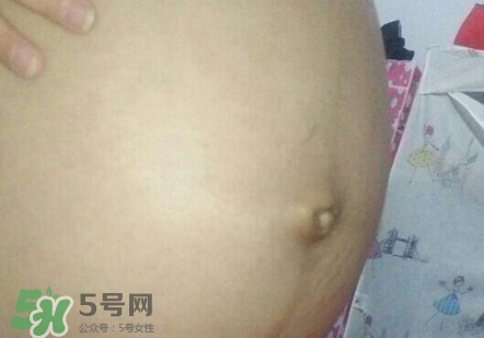 產(chǎn)后肚臍眼臭是怎么回事?產(chǎn)后肚臍眼臭怎么辦? 產(chǎn)后肚臍眼臭是怎么回事?產(chǎn)后肚臍眼臭怎么辦?