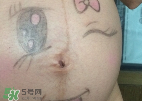 產(chǎn)后肚臍眼臭是怎么回事?產(chǎn)后肚臍眼臭怎么辦? 產(chǎn)后肚臍眼臭是怎么回事?產(chǎn)后肚臍眼臭怎么辦?