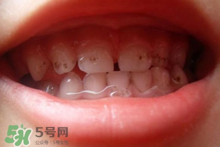 刷牙后吃東西發(fā)苦正常嗎？為什么刷牙后吃東西發(fā)苦？