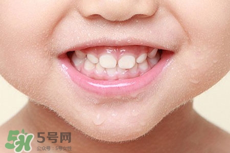 刷牙后吃東西發(fā)苦正常嗎？為什么刷牙后吃東西發(fā)苦？