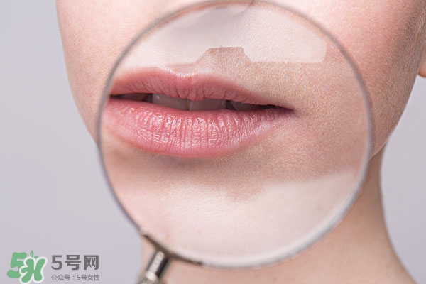 嘴唇起泡腫了怎么辦？嘴唇起泡腫了怎么消腫