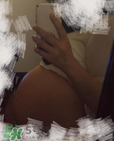 預防妊娠紋用什么好？懷孕期間如何預防妊娠紋