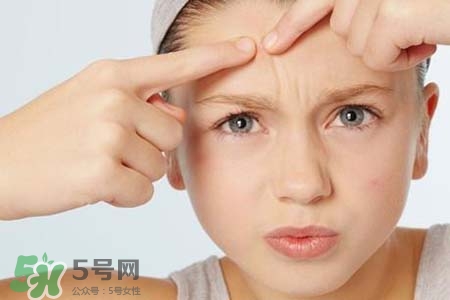 春天臉上冒痘痘怎么辦？為什么春天臉上容易出痘？