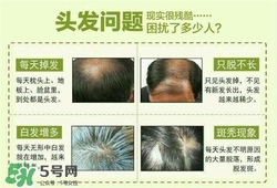 牛角梳梳頭可以生發(fā)嗎？牛角梳怎么梳頭？