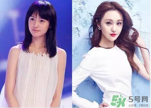 瘦臉針進口好還是國產(chǎn)好？瘦臉針國產(chǎn)和進口的區(qū)別