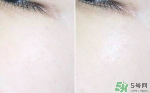 ahc神仙水和b5水區(qū)別 ahc神仙水和ahc b5玻尿酸精華哪個好？