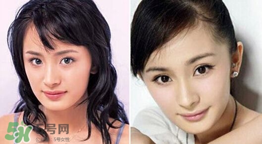 打瘦臉針能懷孕嗎？打瘦臉針能吃避孕藥嗎？