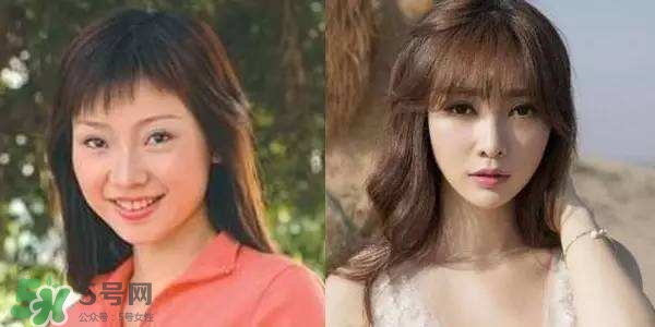 打瘦臉針能懷孕嗎？打瘦臉針能吃避孕藥嗎？