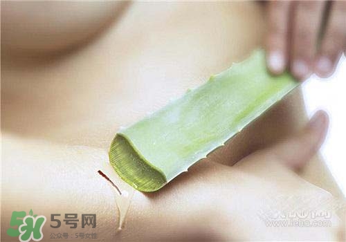 蘆薈涂在臉上發(fā)癢是怎么回事？蘆薈涂在臉上發(fā)癢怎么辦？