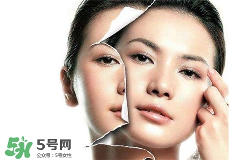 美白針是什么？美白針可以連續(xù)打嗎？