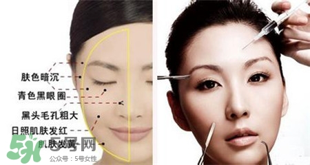 美白針的效果明顯嗎？美白針一個(gè)療程幾次？