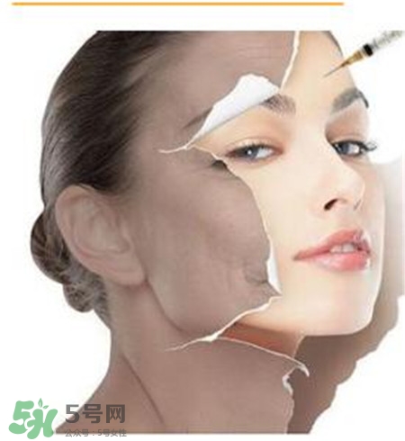 美白針安全嗎？美白針可以自己注射嗎？