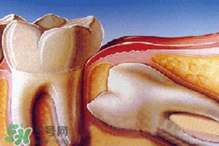 智齒經(jīng)常發(fā)炎怎么辦？智齒反復(fù)發(fā)炎腫痛怎么辦？