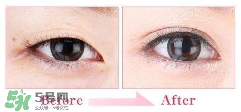 割雙眼皮多少錢？割雙眼皮最佳年齡