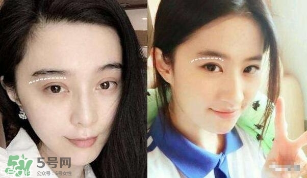 割雙眼皮有幾種做法？雙眼皮有哪幾種形狀？