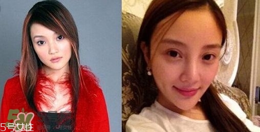 割雙眼皮有幾種做法？雙眼皮有哪幾種形狀？