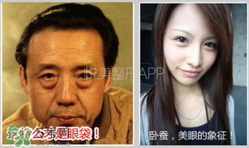 臥蠶是黑眼圈嗎？臥蠶和黑眼圈的區(qū)別