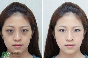 臥蠶是黑眼圈嗎？臥蠶和黑眼圈的區(qū)別