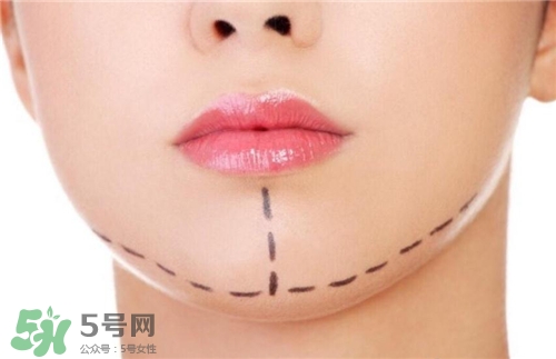 玻尿酸墊下巴能維持多久？玻尿酸墊下巴能維持多長(zhǎng)時(shí)間？