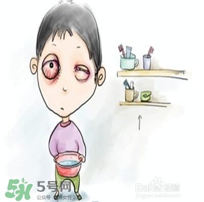 紅眼病是怎么引起的？紅眼病怎么產生的